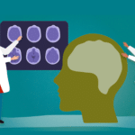 Deteccion temprana del Alzheimer Señales y Síntomas Tempranos