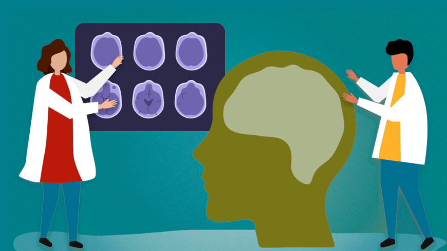 Detección temprana del Alzheimer. Señales y Síntomas Tempranos