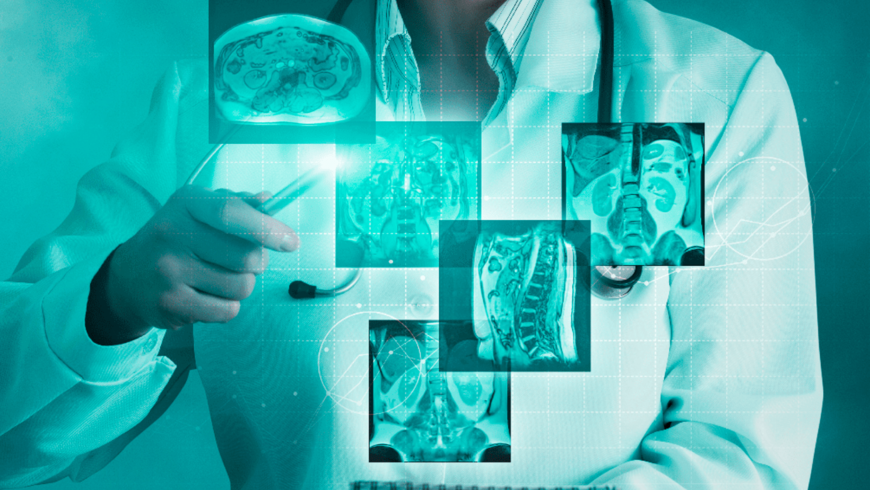 Radiología Digital: Transformando el Diagnóstico Médico
