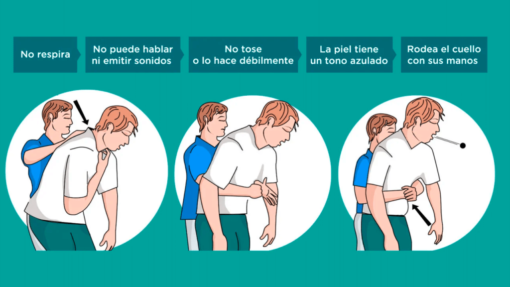 Maniobra de Heimlich en adultos