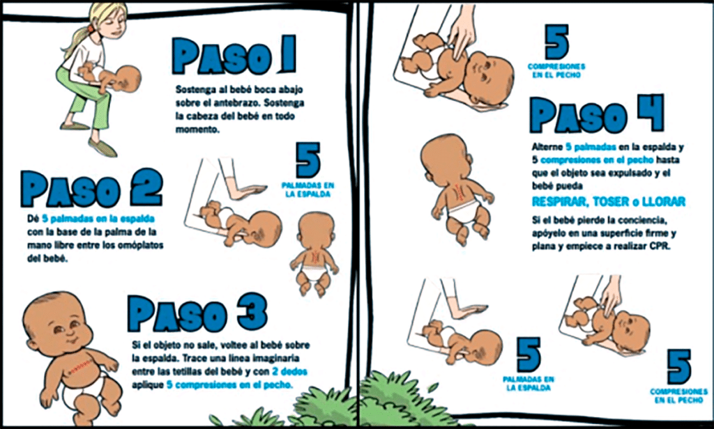Maniobra de Heimlich en bebes