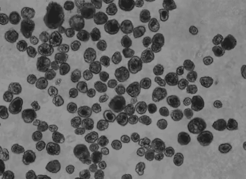 Imagen microscópica de las distintas formas de los anthrobots.